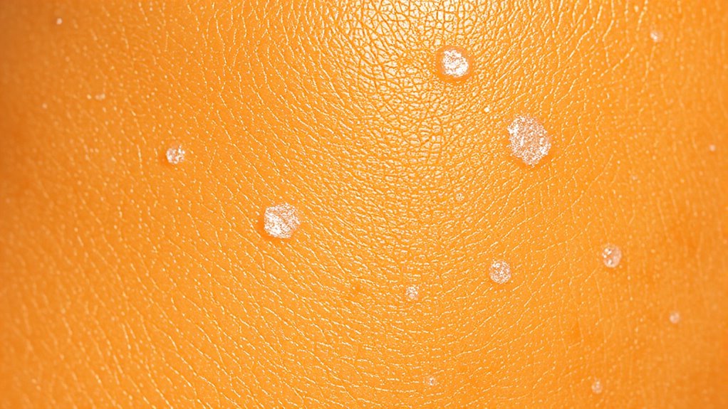 scientific insights on stretch marks