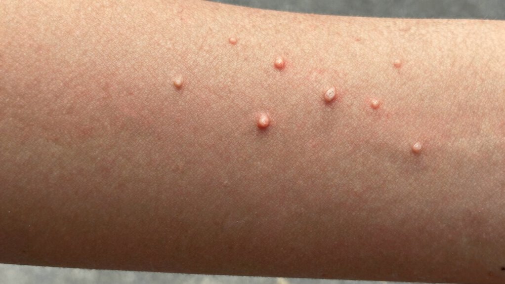 bumpy skin on arms