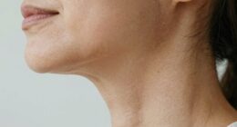 neck ages faster naturally