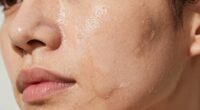 rich creams can dehydrate