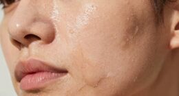 rich creams can dehydrate